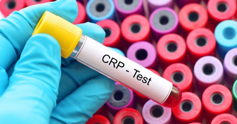 CRP血液検査の完全解説